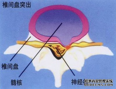 药物流产的有效治疗