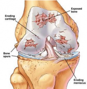 膝盖阴道紧缩是什么？